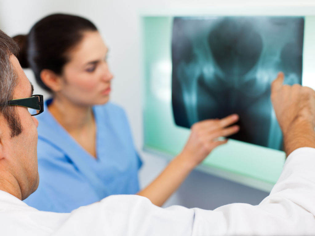 Medical professionals review an X-ray of a hip and pelvis, illustrating diagnosis and long-term treatment needs for serious fracture injuries.