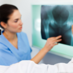 Medical professionals review an X-ray of a hip and pelvis, illustrating diagnosis and long-term treatment needs for serious fracture injuries.